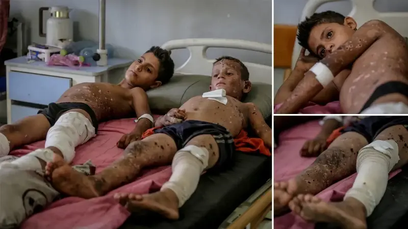 gazzede patlamamis muhimmat infilak etmesi iki cocugu agir yaraladi hqRBLgOr.webp